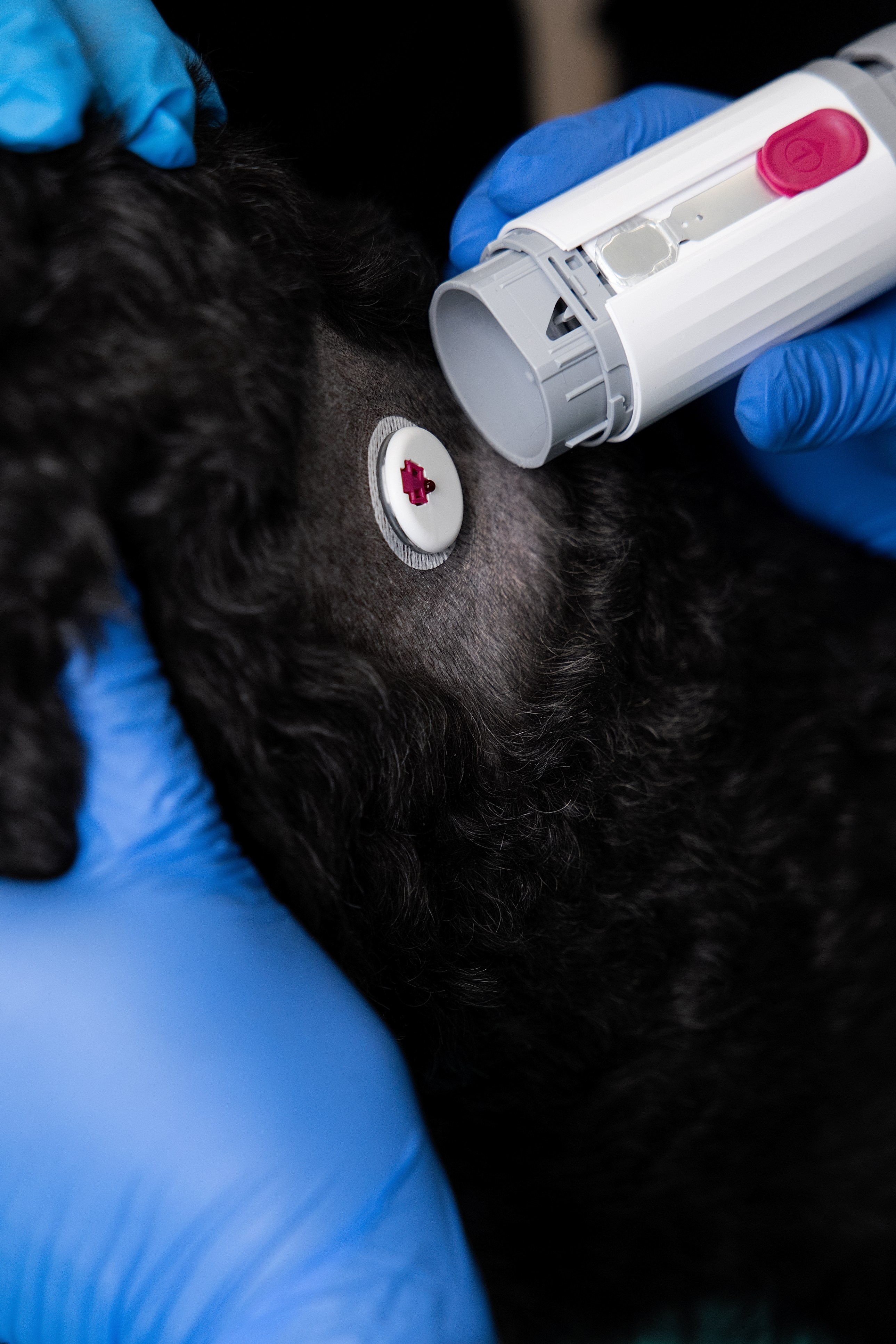 A real diabetic patient examined in clinic — the kind of first case the program is designed for